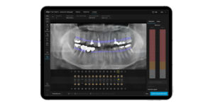 Align X-ray Insights